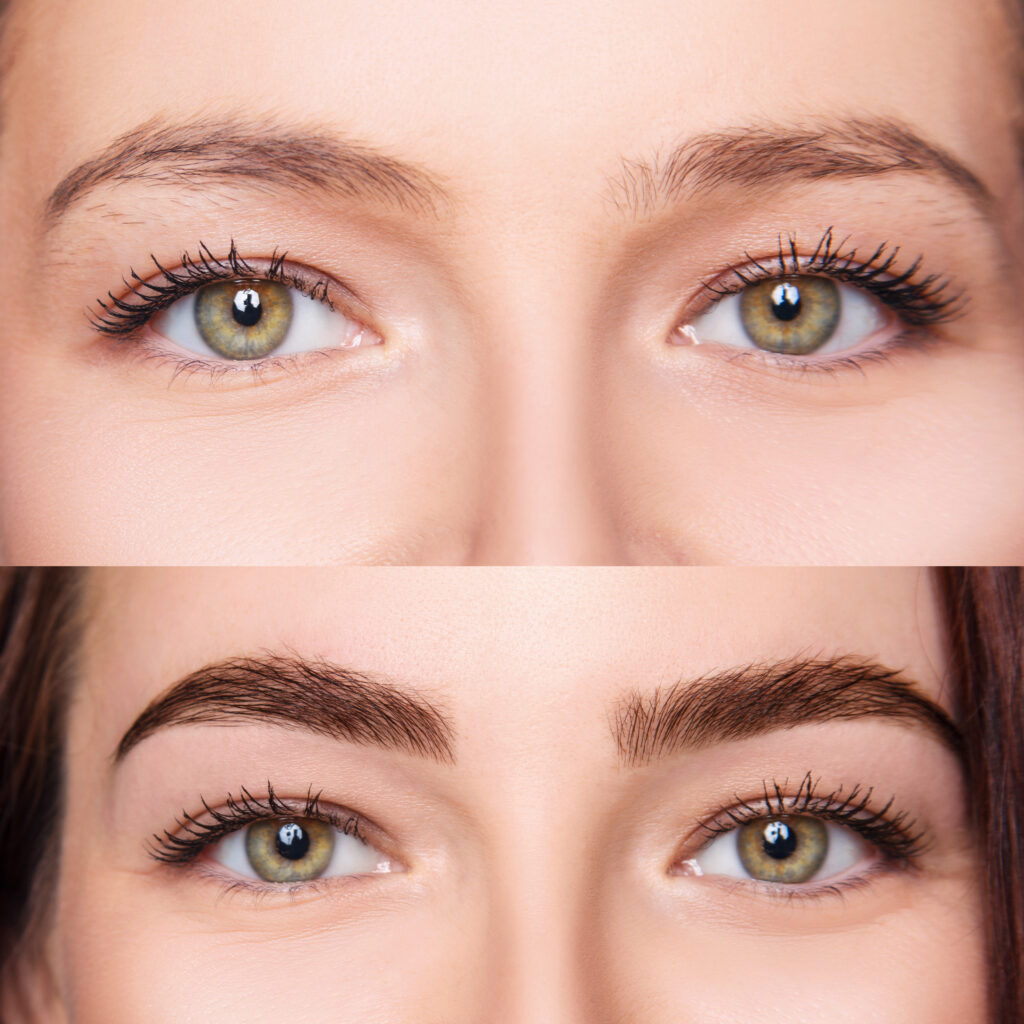 Before and After Brows + Lashes treatment images of Golden Medical Aesthetics in Meridian, ID