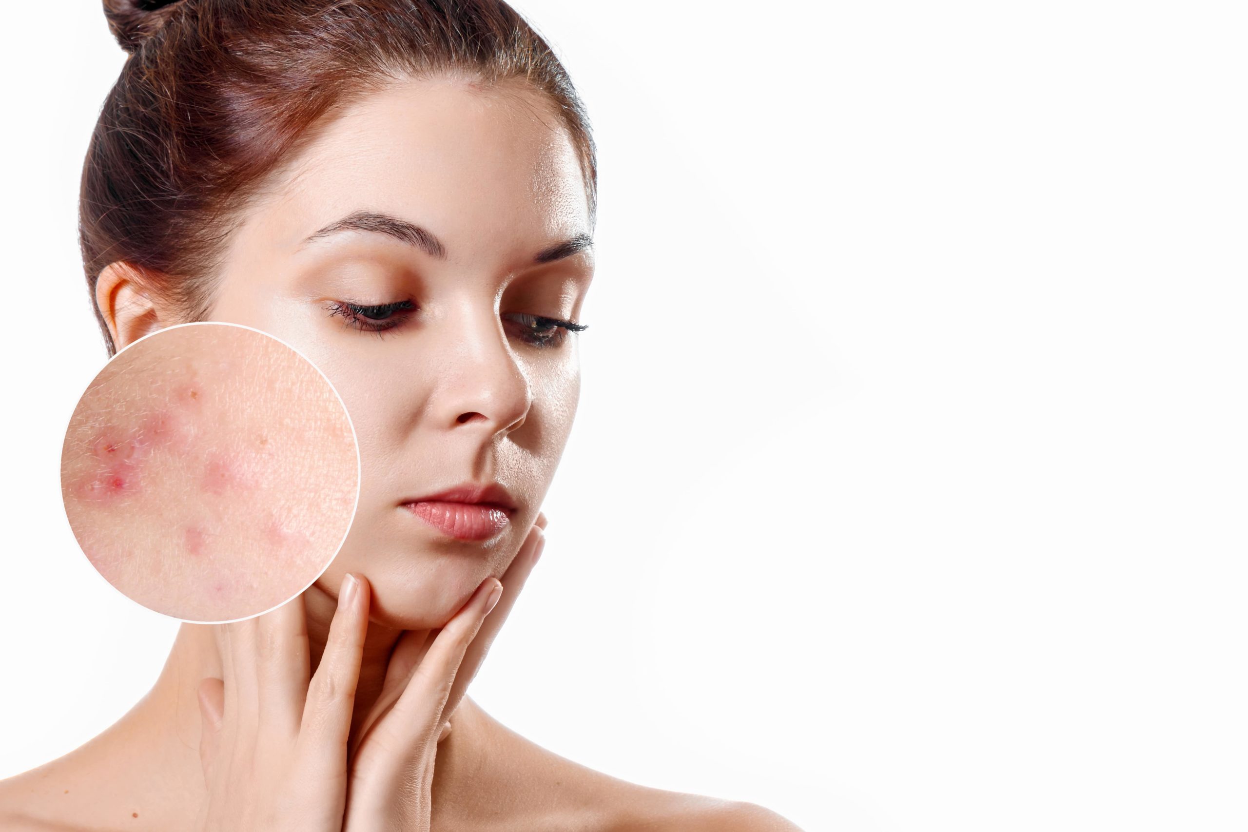 Achieving Radiant Skin Exploring Effective Skin Health Treatments