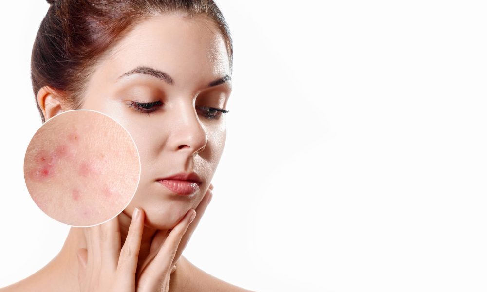 Achieving Radiant Skin Exploring Effective Skin Health Treatments