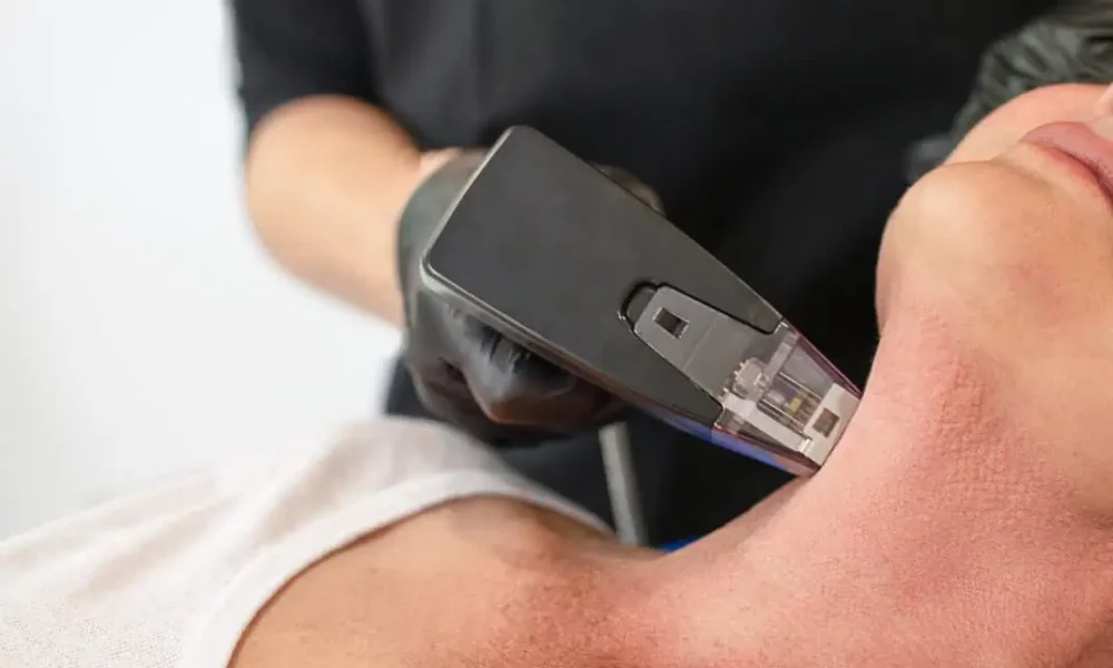 Diolaze Laser Hair Removal in Golden Medical Aesthetics