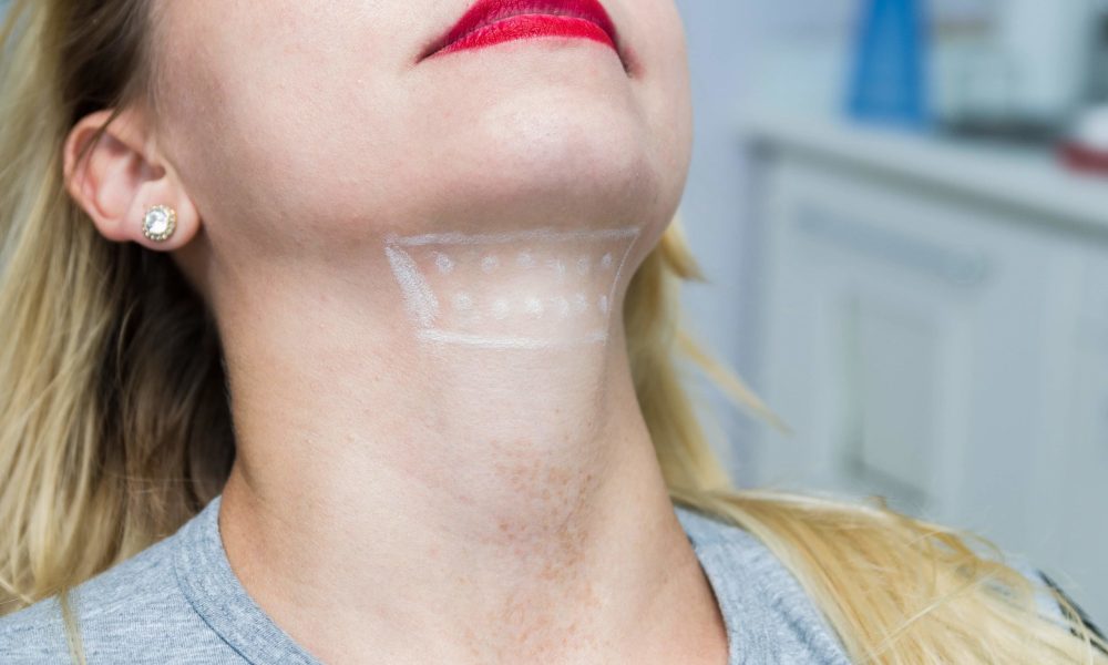 How Much Time is There Between Kybella Treatments